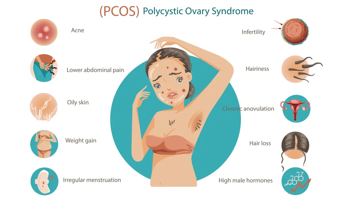 PCOS symptoms